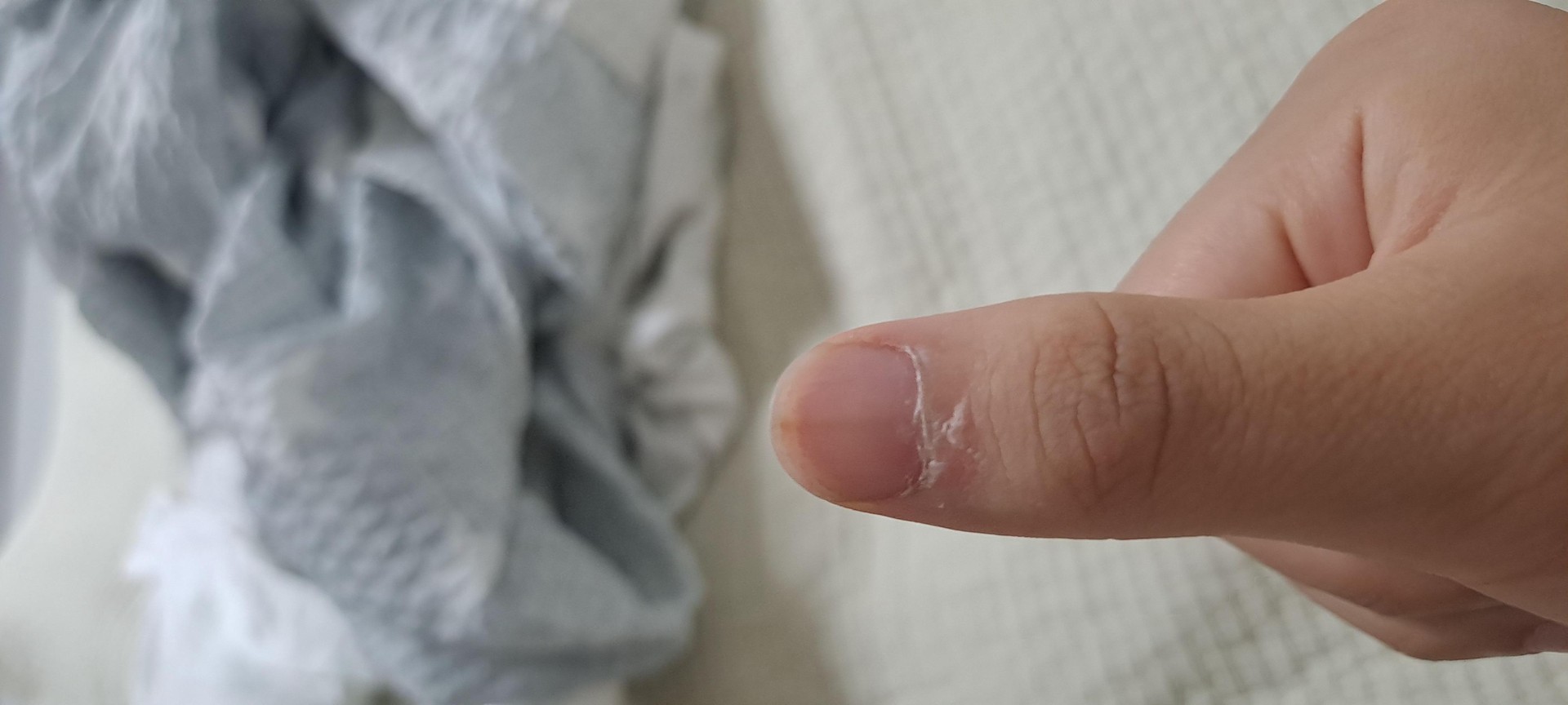 이것봐 나도 몇년 전부터 계속 있었는데 조금씩 사라지는 중