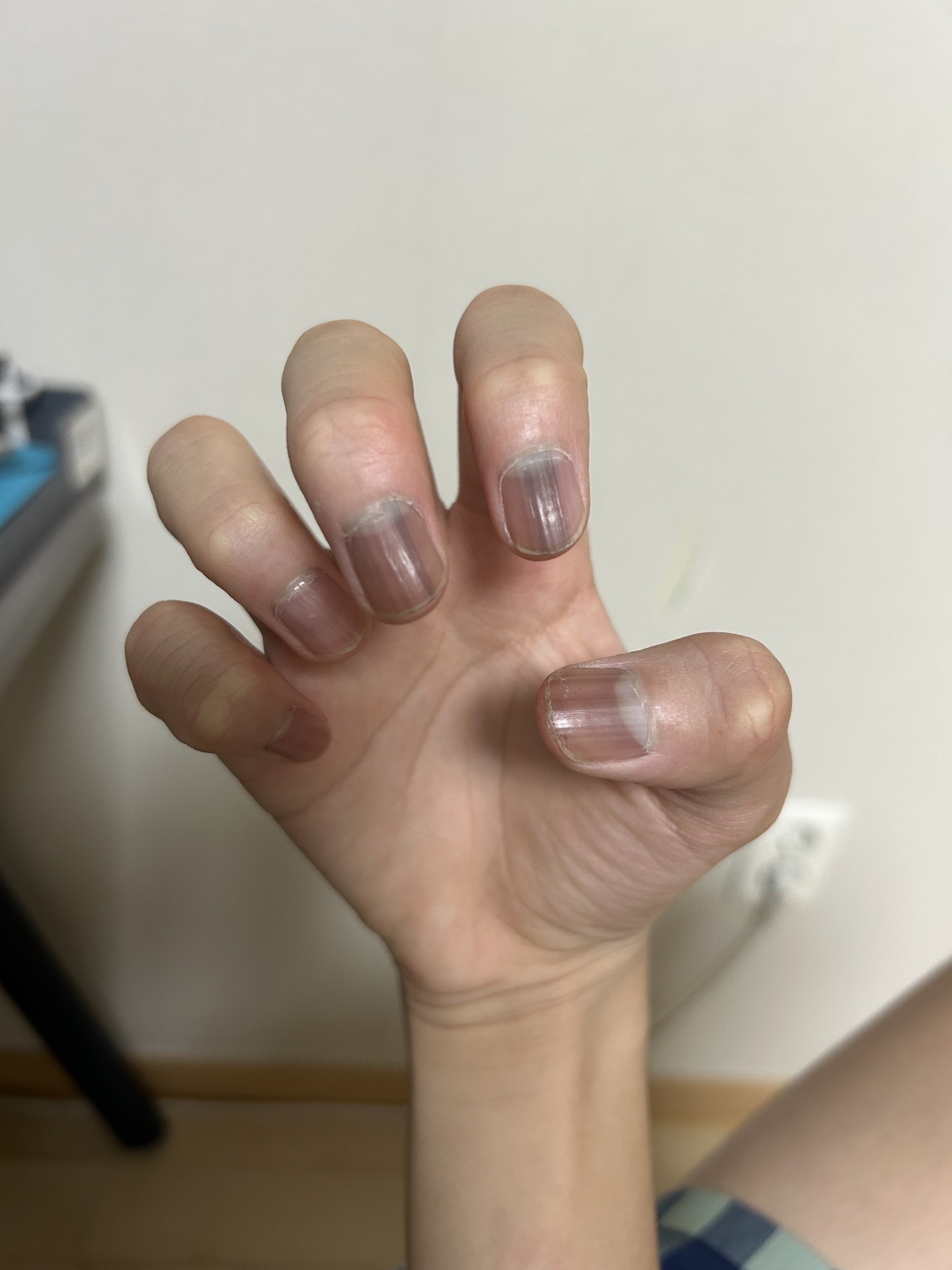 ????난 뭐가 되니???