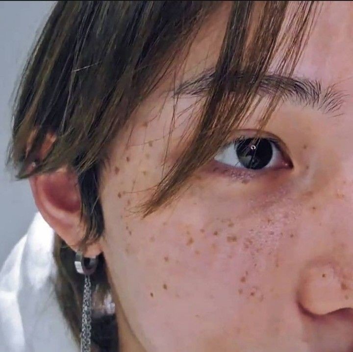 필릭스 주근깨 너무 예쁜 것 같아