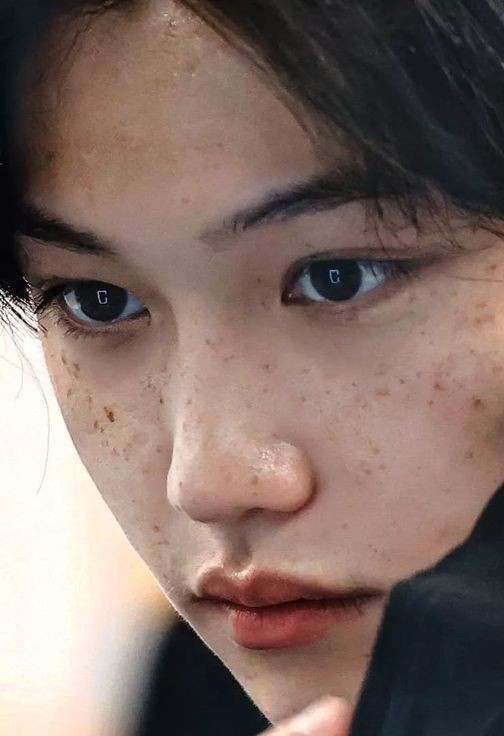 필릭스 주근깨 너무 예쁜 것 같아