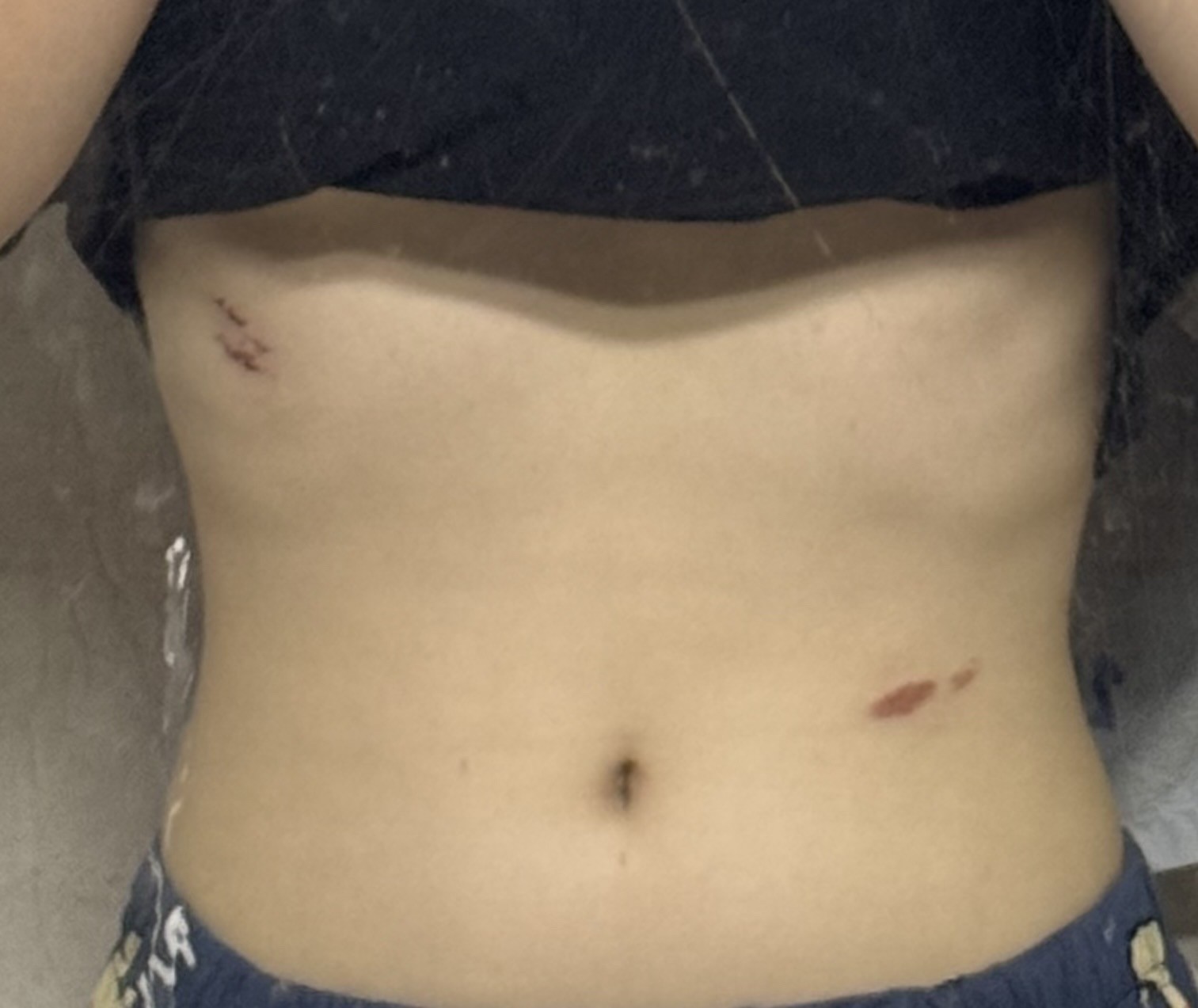 님들 친구랑 목욕탕 갔는데