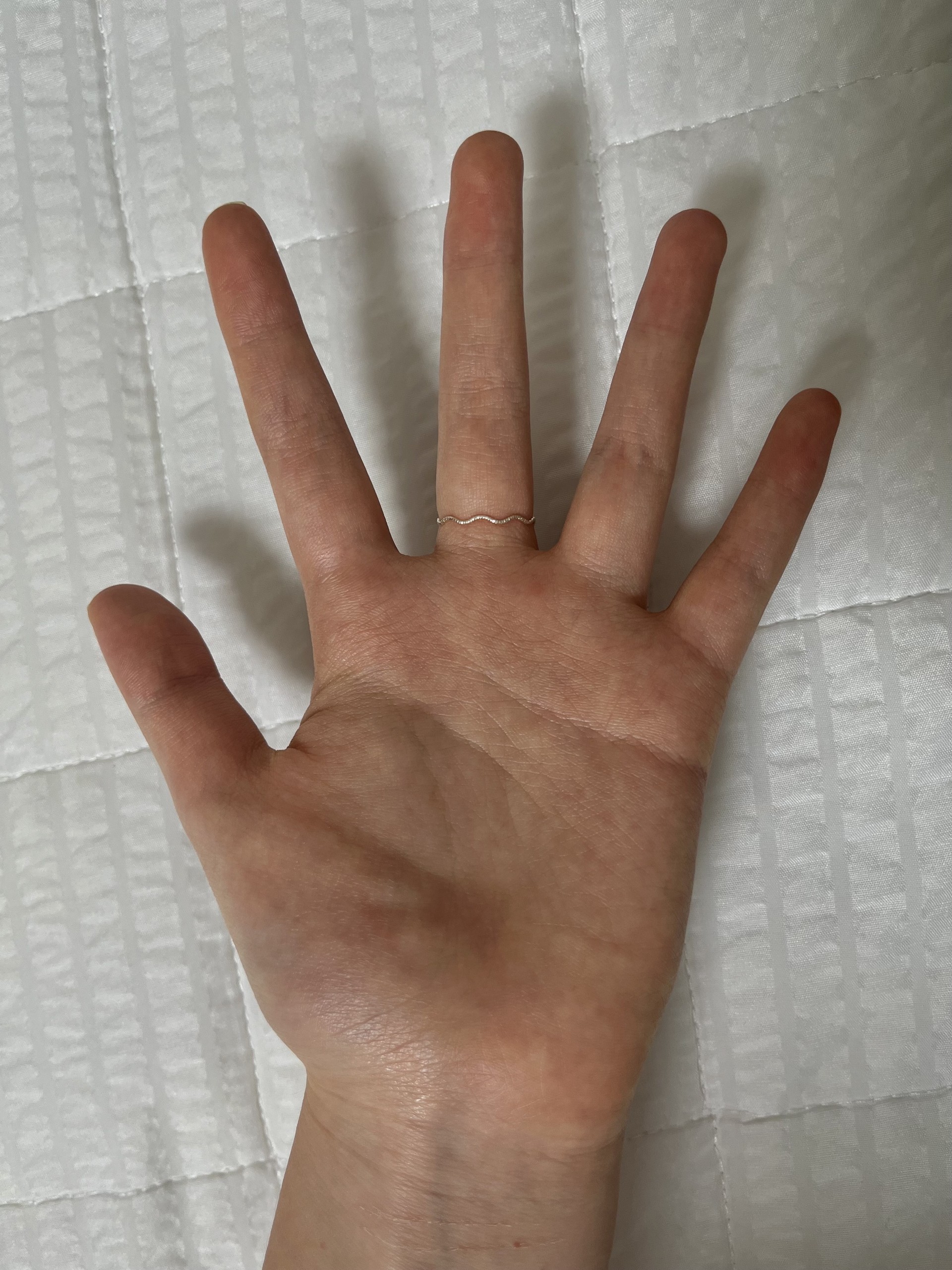 나 단풍손이야??