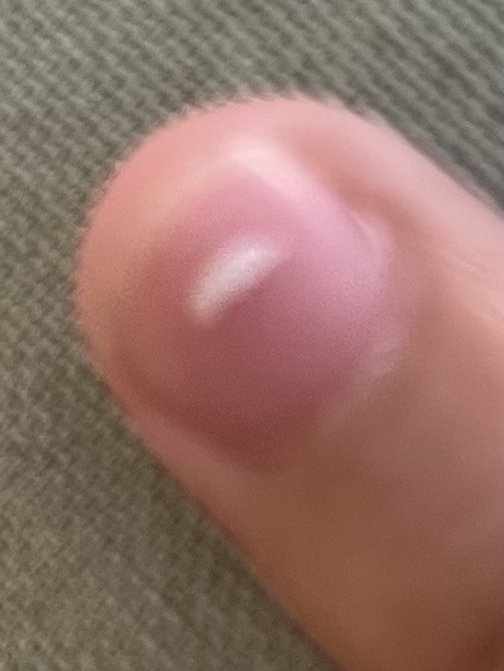 내 손톱 왜 이럼?