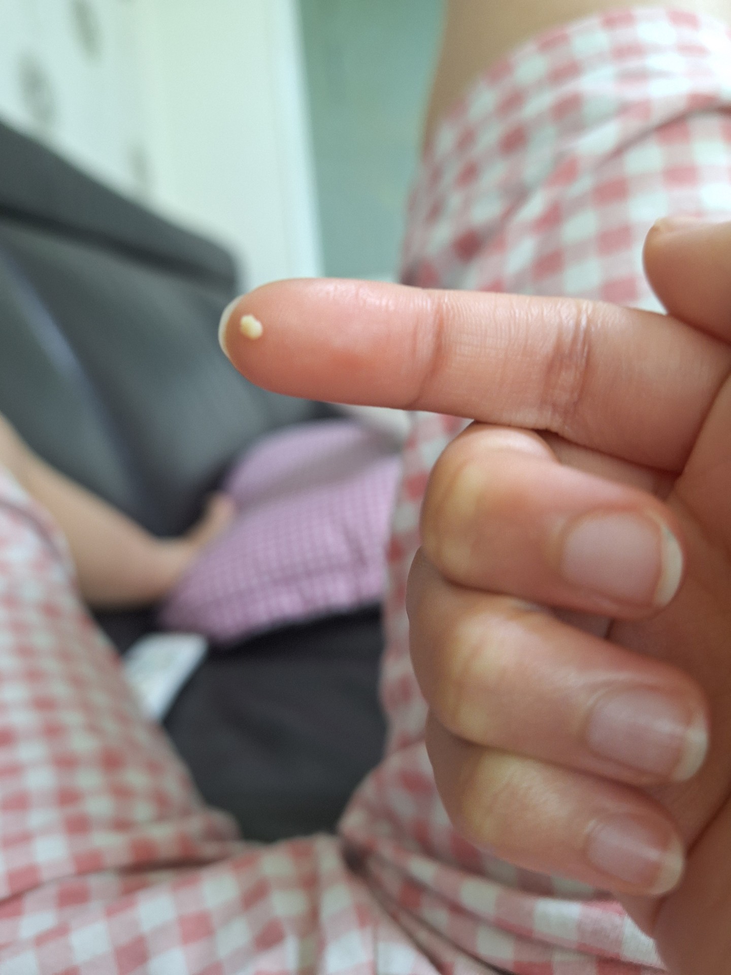 나 목에서 자꾸 이상한게 나와 ㅠㅠ