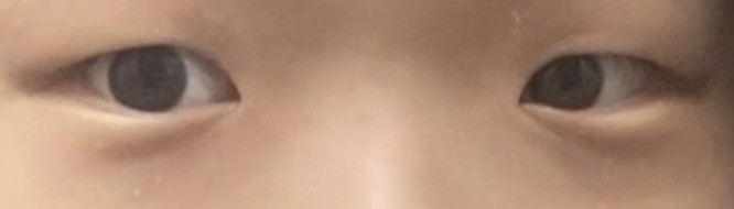 눈 밑에 주름..?있으면 애굣살 어떻게 그려…?ㅠ