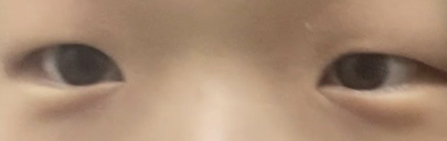 눈 밑에 주름..?있으면 애굣살 어떻게 그려…?ㅠ