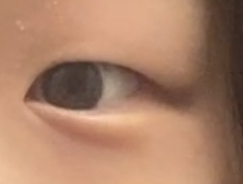 눈 밑에 주름..?있으면 애굣살 어떻게 그려…?ㅠ