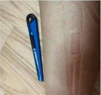 여러분 우울하다고 자해하지 마시고