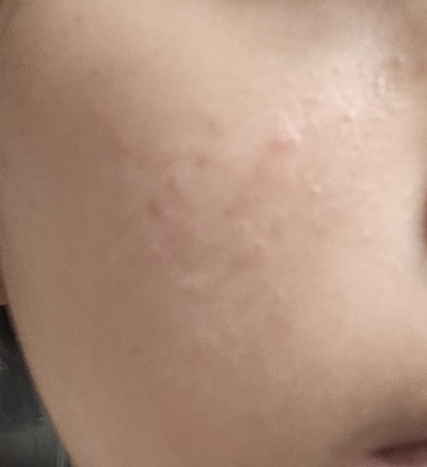 피부 유전이라는 사람들 나와봐