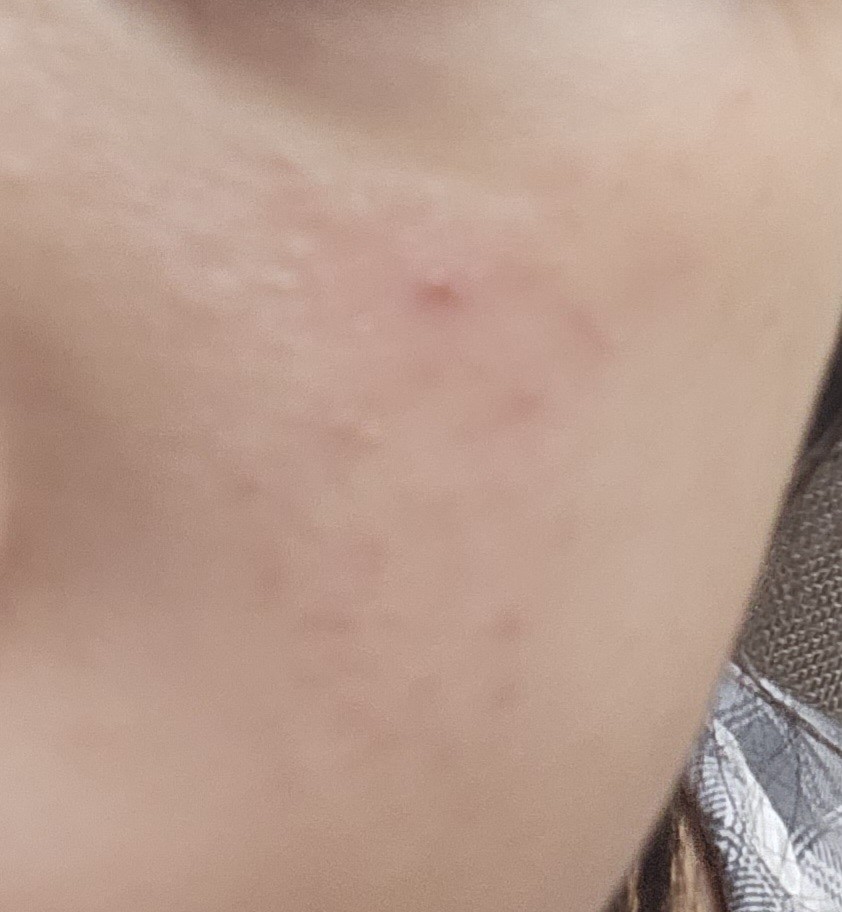 피부 유전이라는 사람들 나와봐