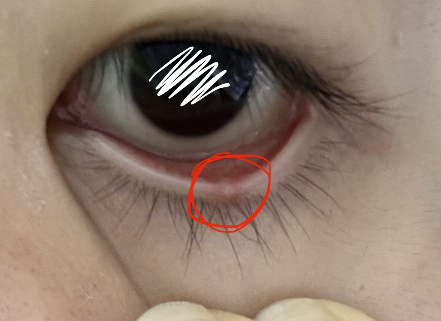 눈에 이게 뭐지?ㅜㅜㅜ