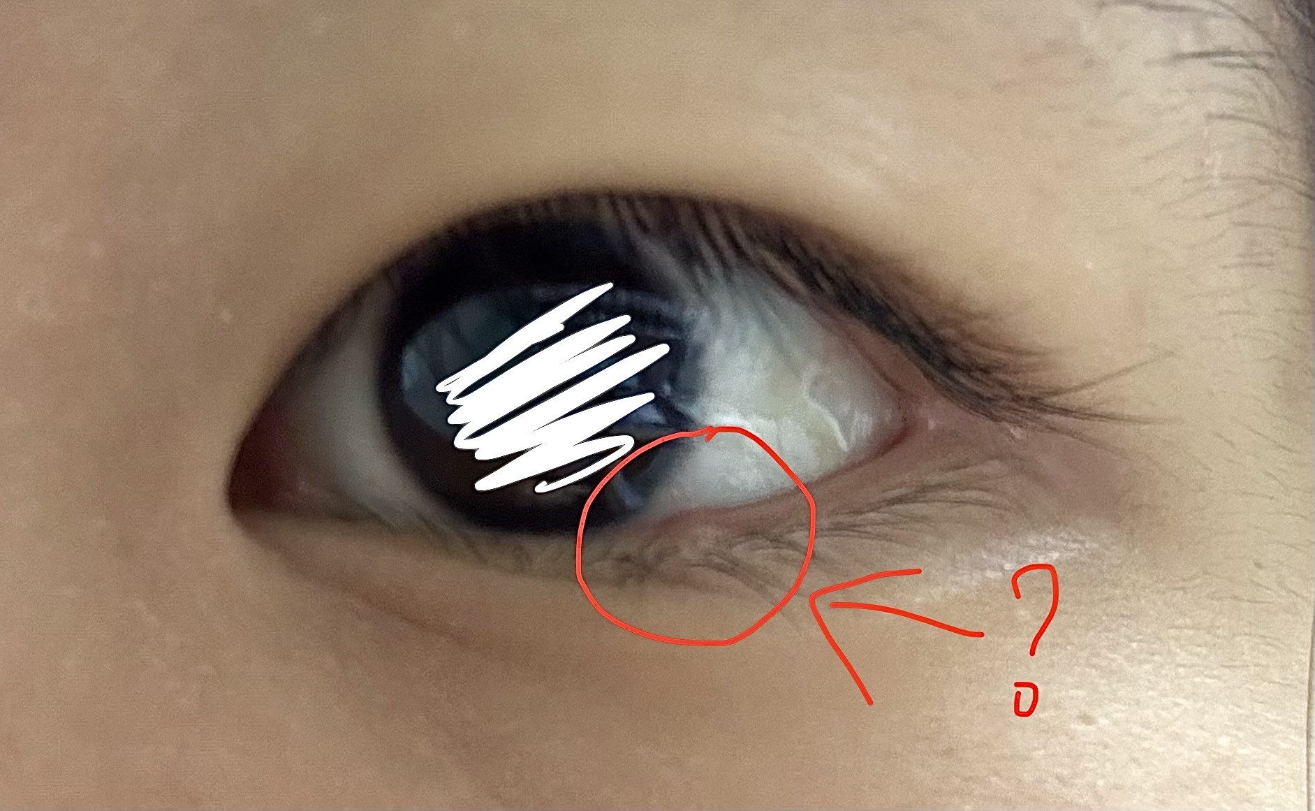 눈에 이게 뭐지?ㅜㅜㅜ