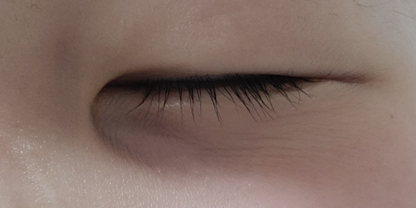 몽고주름,다크서클 없애는법 알아..?