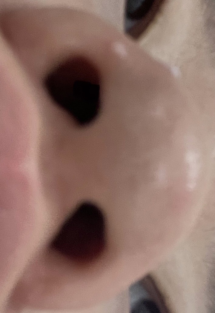 알리 코 보형물