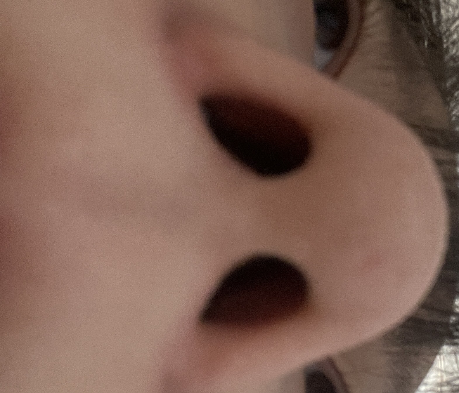 알리 코 보형물
