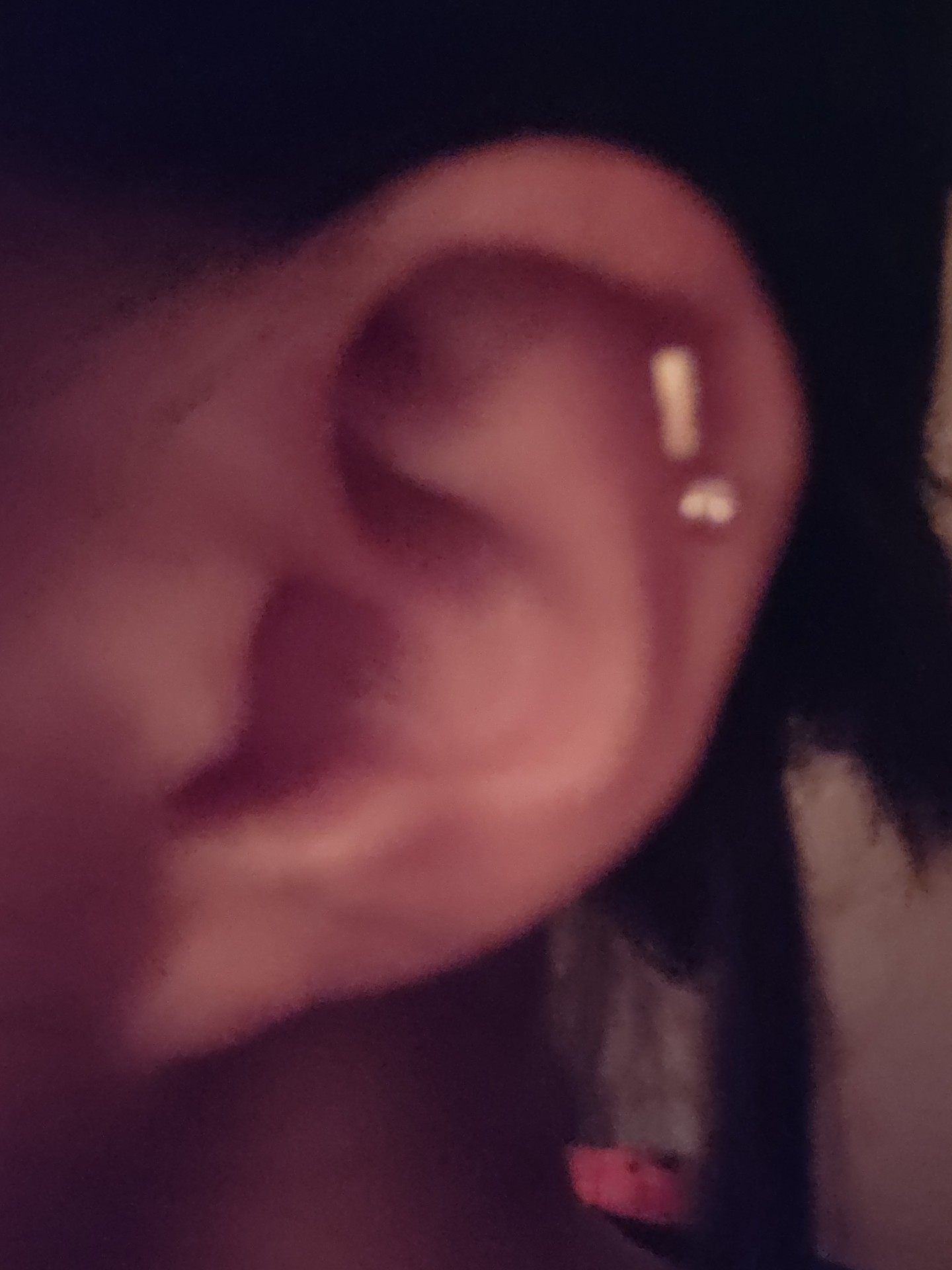 밖이여서.. 좀.. 긴 거 한개랑 둥근 거 한개 있는데 소독 잘하면 됨